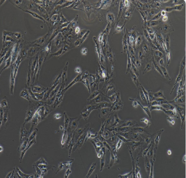 Caki-1人腎透明細胞癌皮膚轉(zhuǎn)移細胞,Caki-1