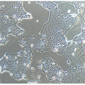 HPF人肺成纤维细胞