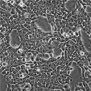 MOLT-4人急性淋巴母细胞白血病细胞,MOLT-4
