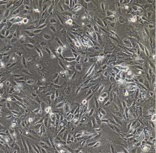 PIG1原代正常人皮肤黑色素细胞,PIG1