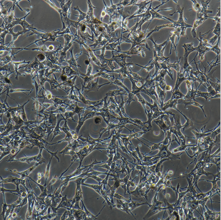 OP9-DL1小鼠骨髓基质细胞,OP9-DL1