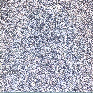 OCI-LY7人B淋巴瘤细胞,OCI-LY7