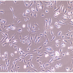 NCI-H295R人腎上腺皮質(zhì)腺癌細(xì)胞