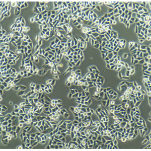 HCC-1588人肺鳞癌细胞