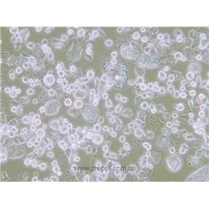 CloneM-3小鼠黑色素瘤细胞