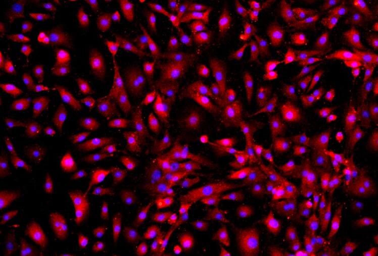 兔肺微血管内皮原代细胞