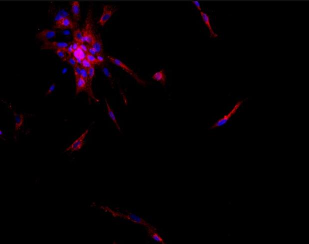 人海马趾神经元原代细胞