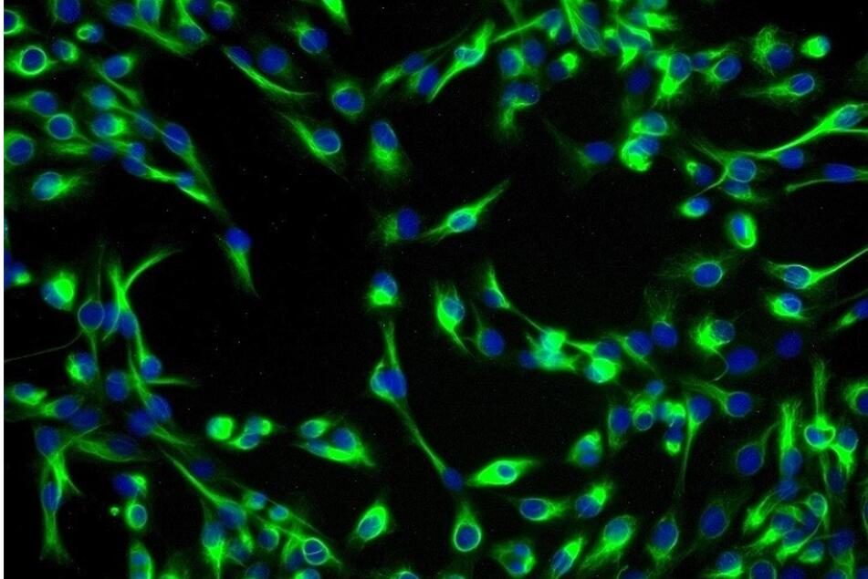 人羊膜间充质基质原代细胞