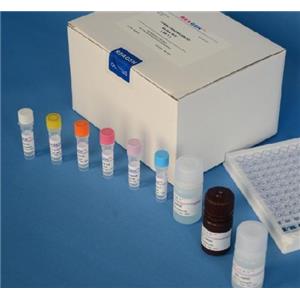 人血管紧张素Ⅰ受体抗体(ANG-ⅠR)Elisa试剂盒