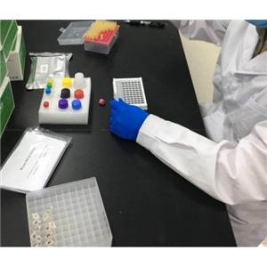 人单核细胞增多性李斯特菌素O((LLO)Elisa试剂盒