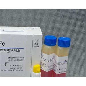 人戊型肝炎病毒IgM(HEV-IgM)Elisa试剂盒