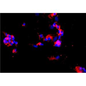 人肝癌组织源原代细胞