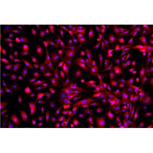 人乳腺癌组织源原代细胞