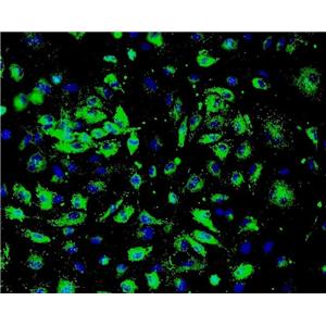 人胰腺癌组织源原代细胞