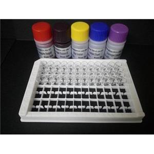 人肠脂肪酸结合蛋白(iFABP)Elisa试剂盒