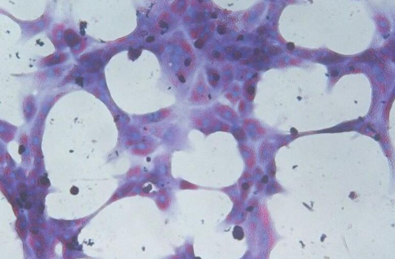 人胎盘绒毛膜滋养层原代细胞
