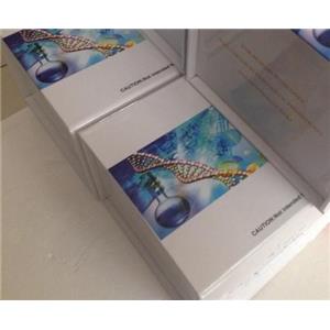 人水通道蛋白5(AQP-5)Elisa试剂盒