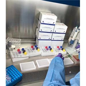 人抗原提呈相关转运蛋白/T细胞活化蛋白(TAP)Elisa试剂盒