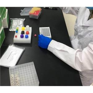 人基质细胞衍生因子1(SDF-1)Elisa试剂盒