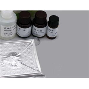 人丙型肝炎病毒(HCV)Elisa试剂盒