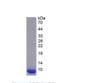 兴奋性氨基酸转运蛋白2(EAAT2)重组蛋白,Recombinant Excitatory Amino Acid Transporter 2 (EAAT2)