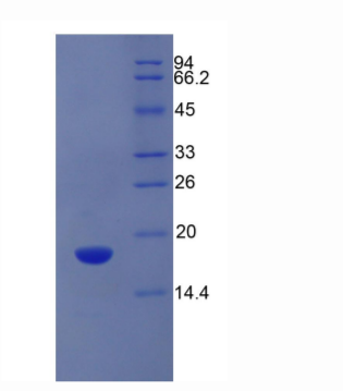 溶质载体家族3成员2(SLC3A2)重组蛋白,Recombinant Solute Carrier Family 3, Member 2 (SLC3A2)