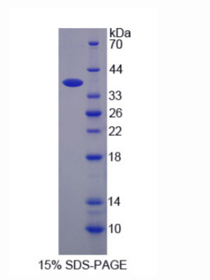 钠钾氯协同转运蛋白2(NKCC2)重组蛋白,Recombinant Na-K-Cl Cotransporter 2 (NKCC2)