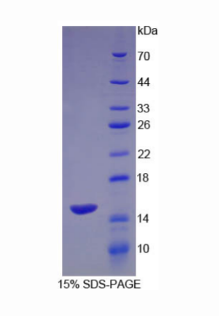 葡萄糖转运蛋白14(GLUT14)重组蛋白,Recombinant Glucose Transporter 14 (GLUT14)