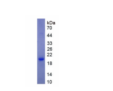 鈉/葡萄糖協(xié)同轉(zhuǎn)運(yùn)蛋白1(SGLT1)重組蛋白,Recombinant Sodium/Glucose Cotransporter 1 (SGLT1)