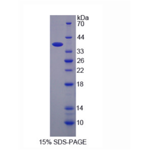 钠钾氯协同转运蛋白2(NKCC2)重组蛋白,Recombinant Na-K-Cl Cotransporter 2 (NKCC2)
