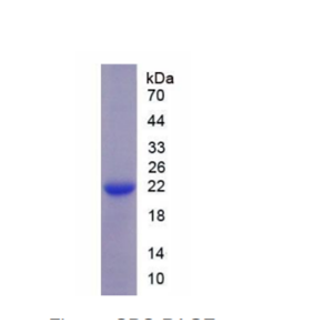 钠氯协同转运蛋白(NCCT)重组蛋白