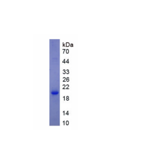 钠/葡萄糖协同转运蛋白1(SGLT1)重组蛋白