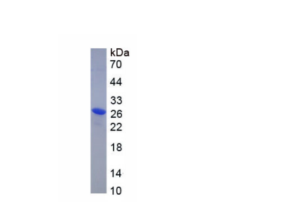 溶質(zhì)載體家族26成員4(SLC26A4)重組蛋白,Recombinant Solute Carrier Family 26, Member 4 (SLC26A4)