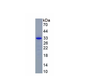 溶质载体家族30成员8(SLC30A8)重组蛋白铁转运蛋白(MFRN)重组蛋白,Recombinant Solute Carrier Family 30 Member 8 (SLC30A8)