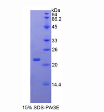 TATA框结合蛋白关联因子12(TAF12)重组蛋白,Recombinant TATA Box Binding Protein Associated Factor 12 (TAF12)
