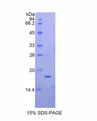 TATA框结合蛋白关联因子13(TAF13)重组蛋白,Recombinant TATA Box Binding Protein Associated Factor 13 (TAF13)