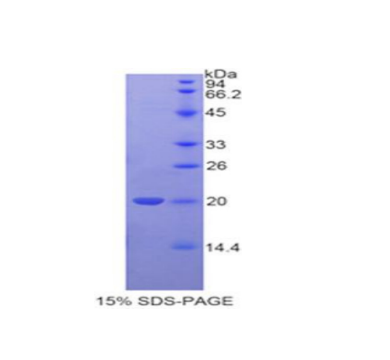 Tafazzin蛋白(TAZ)重组蛋白,Recombinant Tafazzin (TAZ)