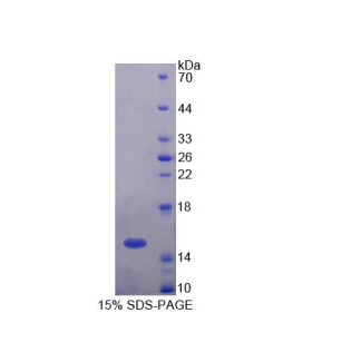 泛素关联蛋白2(UBAP2)重组蛋白,Recombinant Ubiquitin Associated Protein 2 (UBAP2)