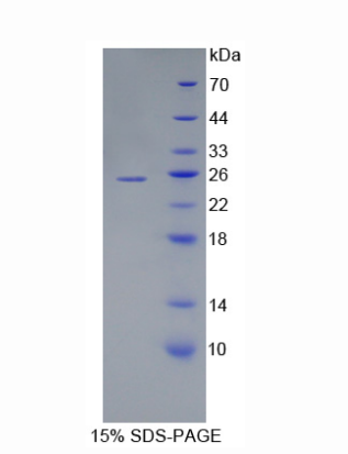 泛素结合酶E2C(UBE2C)重组蛋白,Recombinant Ubiquitin Conjugating Enzyme E2C (UBE2C)