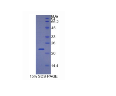 周期素依赖性激酶抑制因子1A(CDKN1A)重组蛋白,Recombinant Cyclin Dependent Kinase Inhibitor 1A (CDKN1A)