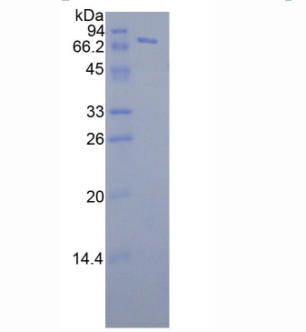 FK506结合蛋白5(FKBP5)重组蛋白,Recombinant FK506 Binding Protein 5 (FKBP5)