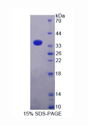 微管蛋白β1(TUBb1)重组蛋白,Recombinant Tubulin Beta 1 (TUBb1)