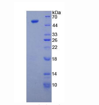 微管蛋白β3(TUBb3)重组蛋白,Recombinant Tubulin Beta 3 (TUBb3)