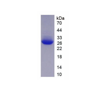 親核素α2(KPNa2)重組蛋白,Recombinant Karyopherin Alpha 2 (KPNa2)