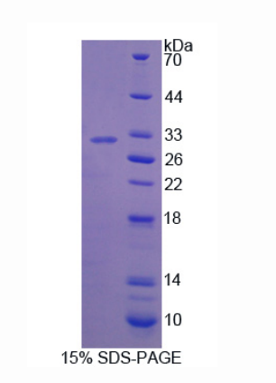 干擾素γ誘導(dǎo)蛋白30(IFI30)重組蛋白,Recombinant Interferon Gamma Inducible Protein 30 (IFI30)