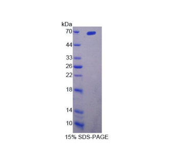 白介素23受体(IL23R)重组蛋白,Recombinant Interleukin 23 Receptor (IL23R)