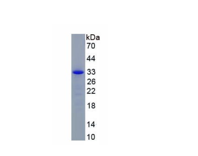 白介素22受體α2(IL22Ra2)重組蛋白,Recombinant Interleukin 22 Receptor Alpha 2 (IL22Ra2)