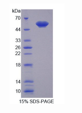 膜联蛋白A11(ANXA11)重组蛋白,Recombinant Annexin A11 (ANXA11)