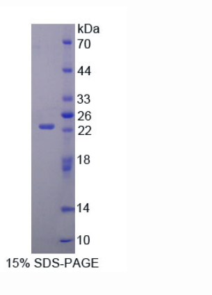 AMPA离子能谷氨酸受体3(GRIA3)重组蛋白,Recombinant Glutamate Receptor, Ionotropic, AMPA 3 (GRIA3)