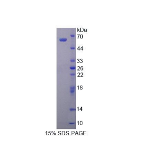 醛脫氫酶1家族成員A1(ALDH1A1)重組蛋白,Recombinant Aldehyde Dehydrogenase 1 Family, Member A1 (ALDH1A1)